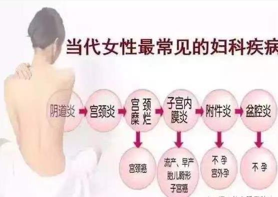 婦科凝膠 婦科凝膠