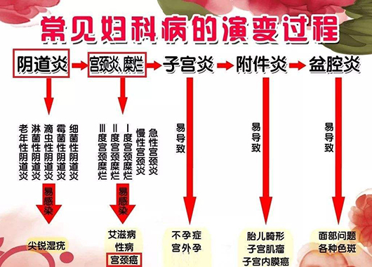 婦科凝膠廠家 婦科凝膠廠家